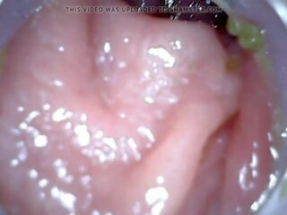 肛門 endoscope 部分 1, 免費 灌腸劑 懲罰 高清晰度 臟 視頻 04